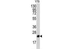 Western Blotting (WB) image for anti-Phosphatidylethanolamine Binding Protein 1 (PEBP1) antibody (ABIN3003677) (PEBP1 抗体)