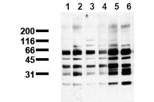 Western Blotting (WB) image for anti-Phosphoserine (phosphorylated) antibody (ABIN126862) (Phosphoserine 抗体  (phosphorylated))