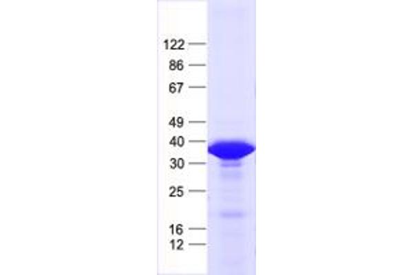 KCTD13 Protein (His tag)