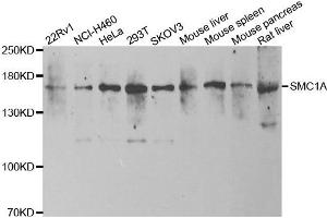 Western blot analysis of extracts of various cell lines, using SMC1A antibody. (SMC1A 抗体)
