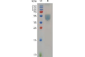 GPR75 Protein (AA 1-46) (Fc Tag)