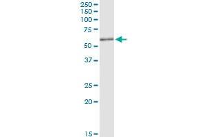 Immunoprecipitation of KIAA0368 transfected lysate using anti-KIAA0368 MaxPab rabbit polyclonal antibody and Protein A Magnetic Bead , and immunoblotted with KIAA0368 purified MaxPab mouse polyclonal antibody (B01P) . (ECM29 抗体  (AA 1-519))