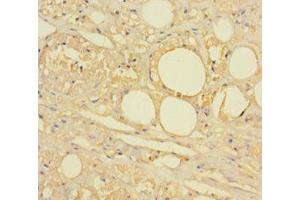 Immunohistochemistry of paraffin-embedded human skin tissue using HTR2A Antibody at dilution 1:100. (HTR2A 抗体  (AA 385-471))