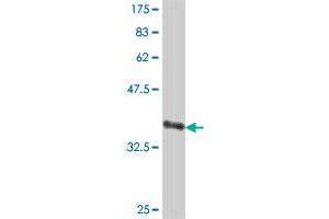 Western Blot detection against Immunogen (38. (ADCY2 抗体  (AA 977-1086))