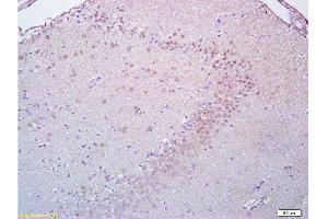 Formalin-fixed and paraffin embedded rat brain tissue labeled with Anti-Brdu Polyclonal Antibody, Unconjugated  at 1:200, followed by conjugation to the secondary antibody and DAB staining (BrdU 抗体)