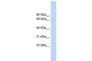 PARP6 antibody used at 1. (PARP6 抗体  (N-Term))