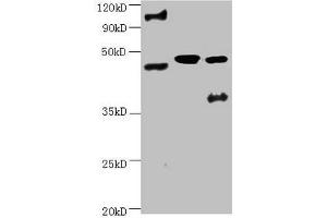 All lanes:Mouse anti-human ENO2 monoclonal antibody at 1 μg/mL Lane 1:Hela cell lysate Lane 2:Recombinant Human Gamma-enolase(ENO2) at 10 μg Lane 3:U251 cell lysate Secondary Goat polyclonal to Mouse IgG at 1/3000 dilution Predicted band size : 43,48 kD Observed band size: 48 kD Additional bands at : 100 kDa. (ENO2/NSE 抗体)