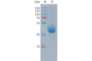 Cynomolgus CD3E Protein, hFc Tag on SDS-PAGE under reducing condition. (CD3 epsilon Protein (CD3E) (AA 22-117) (Fc Tag))