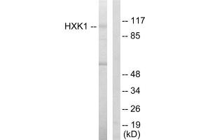 Western blot analysis of extracts from HeLa cells, using HXK1 antibody. (Hexokinase 1 抗体  (N-Term))
