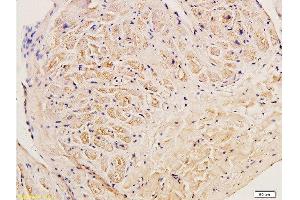 Immunohistochemistry (Paraffin-embedded Sections) (IHC (p)) image for anti-Collagen, Type III (COL3) (AA 1301-1400) antibody (ABIN669981)