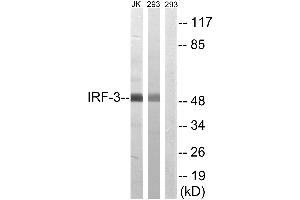 Western blot analysis of extracts from Jurkat cells and 293 cells, using IRF-3 (Ab-386) antibody. (IRF3 抗体  (Ser386))