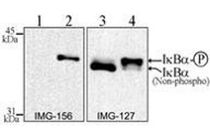 Western Blotting (WB) image for anti-Nuclear Factor of kappa Light Polypeptide Gene Enhancer in B-Cells Inhibitor, alpha (NFKBIA) (Internal Region) antibody (ABIN6655971)