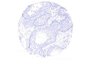 testis (Recombinant Cytokeratin 7 抗体  (AA 1-100))