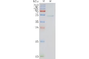 Human -Nanodisc, Flag Tag on SDS-PAGE (HRH3 蛋白)