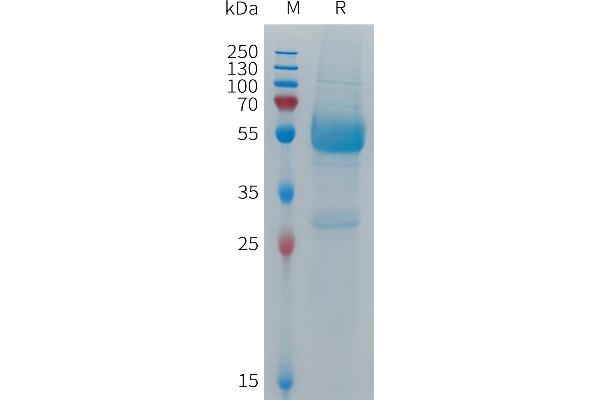 IREM1 Protein (AA 20-155) (Fc Tag)