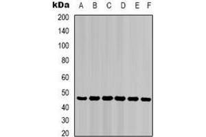 Western blot analysis of Cytokeratin 18 expression in HepG2 (A), Hela (B), mouse liver (C), mouse skeletal muscle (D), C2C12 (E), rat heart (F) whole cell lysates. (Cytokeratin 18 抗体)
