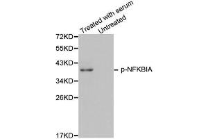 Western Blotting (WB) image for anti-Nuclear Factor of kappa Light Polypeptide Gene Enhancer in B-Cells Inhibitor, alpha (NFKBIA) (pTyr42) antibody (ABIN1870480) (NFKBIA 抗体  (pTyr42))