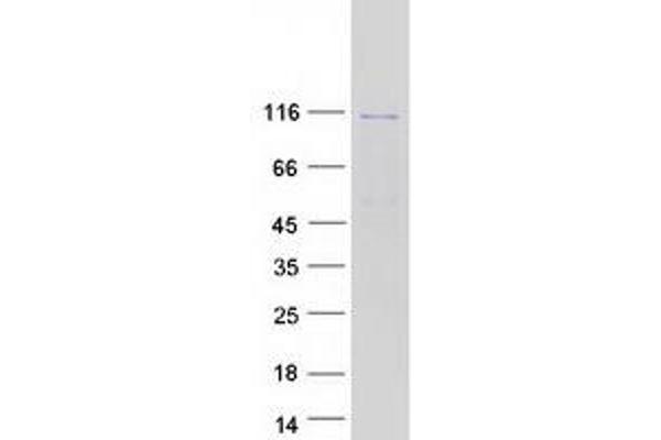 GUCY2D Protein (Myc-DYKDDDDK Tag)