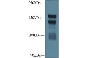 Western Blotting (WB) image for Thrombospondin 1 (THBS1) ELISA Kit (ABIN6574176)