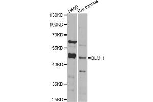 Western blot analysis of extracts of various cell lines, using BLMH Antibody (ABIN2561425) at 1:1000 dilution. (BLMH 抗体)