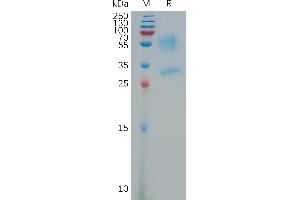 Human PR Protein, hFc Tag on SDS-PAGE under reducing condition. (Prokineticin Receptor 1 Protein (PROKR1) (AA 1-62) (Fc Tag))