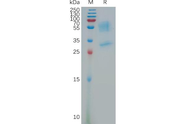 Prokineticin Receptor 1 Protein (PROKR1) (AA 1-62) (Fc Tag)