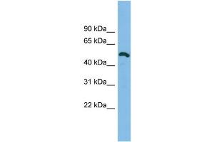 WB Suggested Anti-DKFZp779O175 Antibody Titration: 0. (DKFZp779O175 (Middle Region) 抗体)