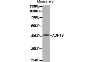 Western Blotting (WB) image for anti-Alcohol Dehydrogenase 1B (Class I), beta Polypeptide (ADH1B) (AA 206-375) antibody (ABIN6218524) (ADH1B 抗体  (AA 206-375))