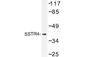Image no. 1 for anti-Somatostatin Receptor 4 (SSTR4) antibody (ABIN317867) (SSTR4 抗体)