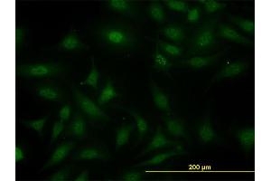 Immunofluorescence of monoclonal antibody to SUGT1 on HeLa cell. (SUGT1 抗体  (AA 151-260))
