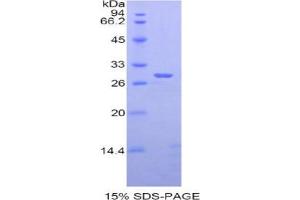 SDS-PAGE (SDS) image for A Disintegrin and Metallopeptidase Domain 6A (ADAM6A) (AA 419-664) protein (His tag) (ABIN1878157) (ADAM6A Protein (AA 419-664) (His tag))