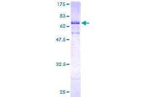 Image no. 1 for Cathepsin E (CTSE) (AA 18-396) protein (GST tag) (ABIN1350710) (Cathepsin E Protein (CTSE) (AA 18-396) (GST tag))