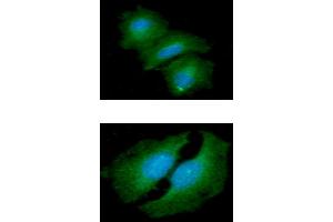 ICC/IF analysis of HTATIP2 in A549 cells line, stained with DAPI (Blue) for nucleus staining and monoclonal anti-human HTATIP2 antibody (1:100) with goat anti-mouse IgG-Alexa fluor 488 conjugate (Green). (HIV-1 Tat Interactive Protein 2, 30kDa (HTATIP2) 抗体)