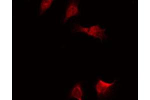 Immunofluorescence (fixed cells) (IF/ICC) image for anti-Nuclear Factor-kB p65 (NFkBP65) (pSer536) antibody (ABIN6255402)