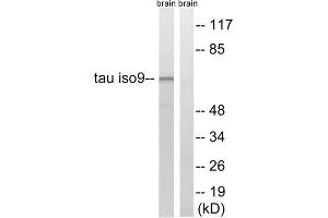 Western blot analysis of extracts from rat brain cells, using Tau (epitope around residue 534/217) antibody. (tau 抗体  (Thr217, Thr534))