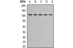 Western blot analysis of DNA Ligase 3 expression in Jurkat (A), NIH3T3 (B), MCF7 (C), PC3 (D), Hela (E) whole cell lysates. (LIG3 抗体)