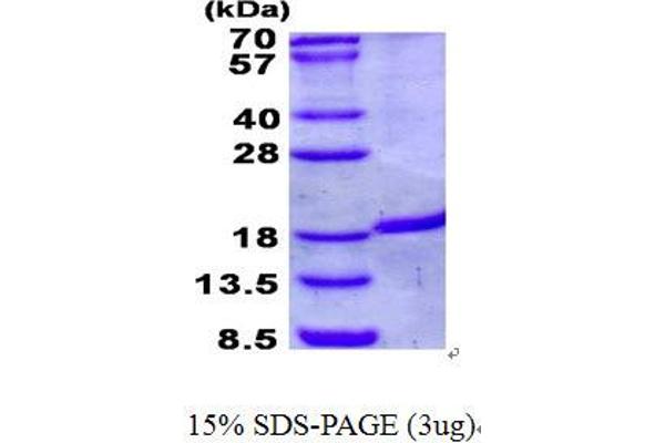 IRGM Protein (His tag)