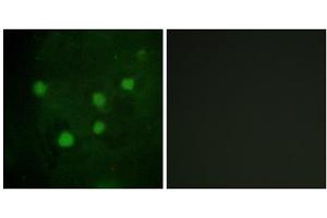 Immunofluorescence analysis of HUVEC cells, using BAF250B antibody. (ARID1B 抗体  (Internal Region))