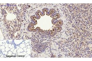 Immunohistochemical analysis of paraffin-embedded rat lung tissue. (PI3K p85 alpha/gamma 抗体)