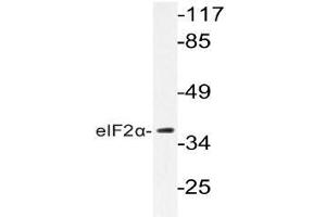Western blot (WB) analyzes of eIF2alpha antibody in extracts from K562 cells. (EIF2S1 抗体)