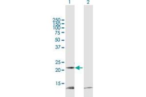 Western Blot analysis of PRDX5 expression in transfected 293T cell line by PRDX5 MaxPab polyclonal antibody. (Peroxiredoxin 5 抗体  (AA 1-214))