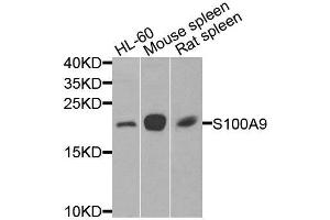 Western blot analysis of extracts of various cell lines, using S100A9 antibody (ABIN6003574) at 1/1000 dilution. (S100A9 抗体)