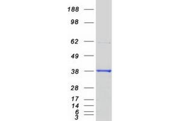 PHYH Protein (Transcript Variant 1) (Myc-DYKDDDDK Tag)