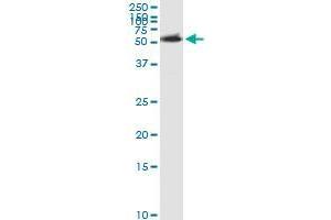 Immunoprecipitation of ACCS transfected lysate using rabbit polyclonal anti-ACCS and Protein A Magnetic Bead (ACCS (人) IP-WB Antibody Pair)