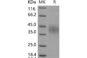 Western Blotting (WB) image for Protein C Receptor, Endothelial (PROCR) protein (His tag) (ABIN7320123) (PROCR Protein (His tag))