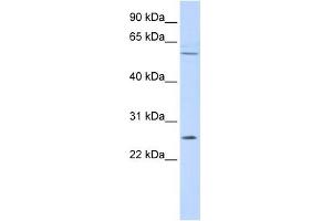 FAM124A antibody used at 1 ug/ml to detect target protein. (FAM124A 抗体  (Middle Region))