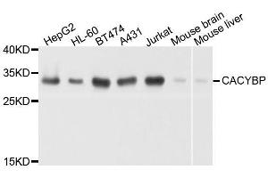 Western blot analysis of extracts of various cell lines, using CACYBP antibody. (CACYBP 抗体  (AA 1-228))