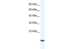 WB Suggested Anti-CSRP3 Antibody Titration:  0. (CSRP3 抗体  (Middle Region))