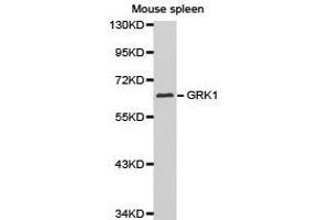 Western Blotting (WB) image for anti-G Protein-Coupled Receptor Kinase 1 (GRK1) antibody (ABIN1872898) (GRK1 抗体)