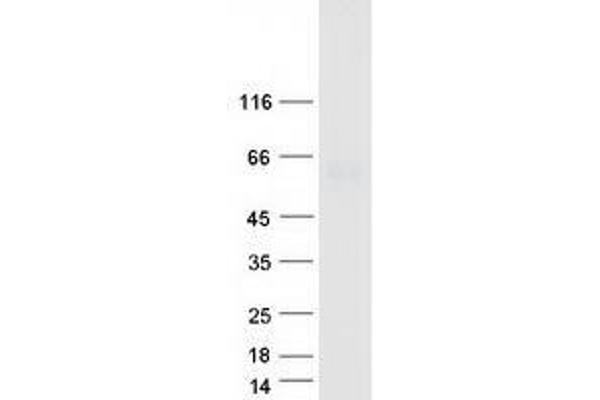 UGT1A6 Protein (Transcript Variant 2) (Myc-DYKDDDDK Tag)